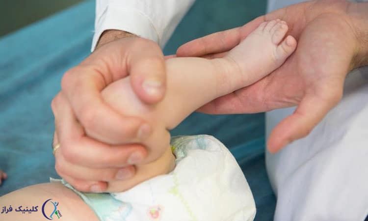 مشکلات ارتوپدی اطفال