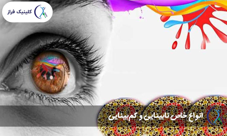 انواع خاص نابینایی و کم‌بینایی