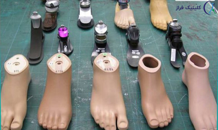 اجزای پروتز پا