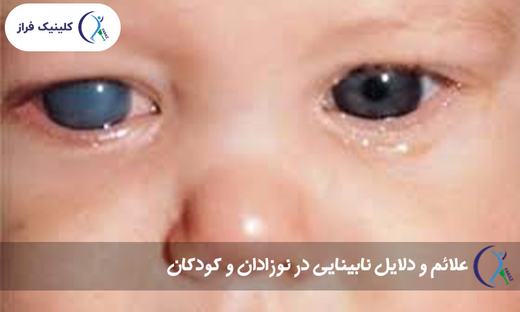 علائم و دلایل نابینایی در نوزادان و کودکان