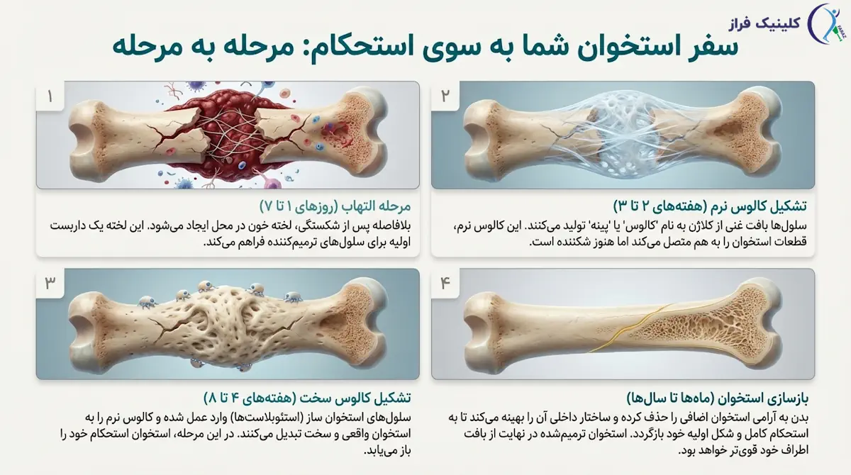 مدت زمان جوش خوردن استخوان