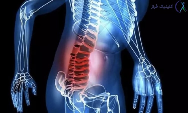 حرکات مضر برای دیسک کمر