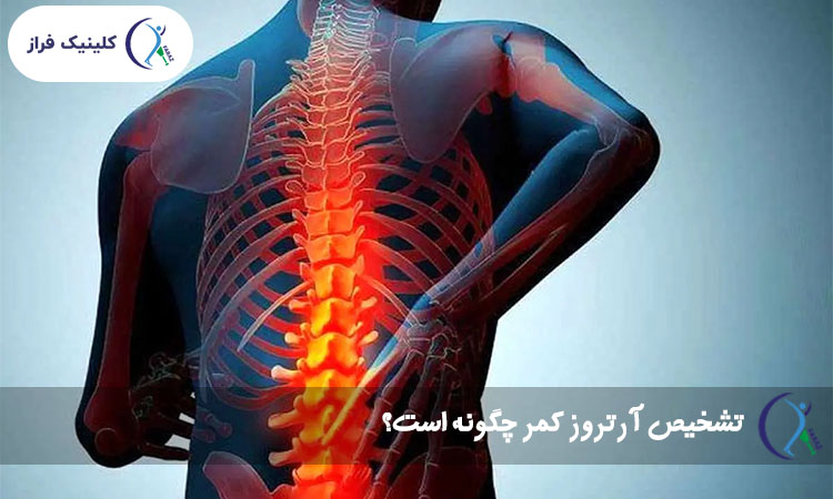 تشخیص آرتروز کمر چگونه است؟