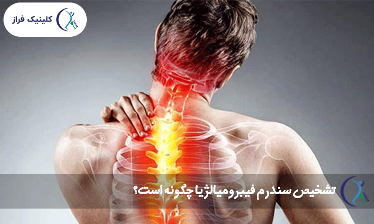 تشخیص سندرم فیبرومیالژیا چگونه است؟