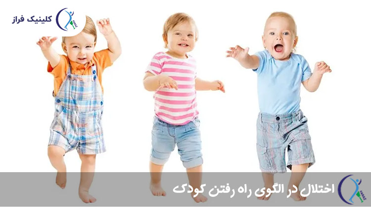 اختلال در الگوی راه رفتن کودکان