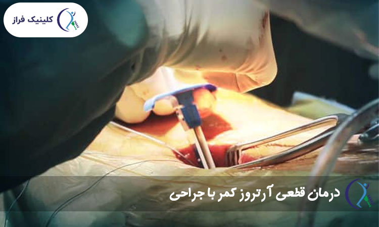 درمان قطعی آرتروز کمر با جراحی