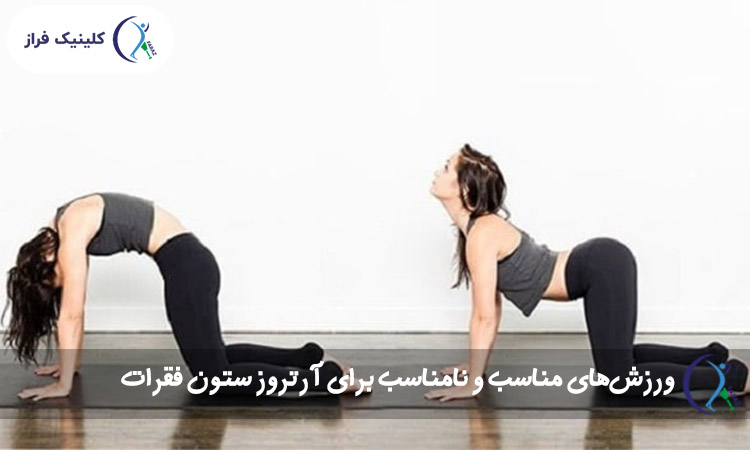 ورزش‌های مناسب و نامناسب برای آرتروز ستون فقرات