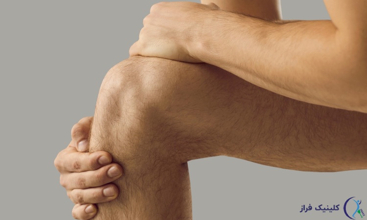 عکس استخوان اضافه