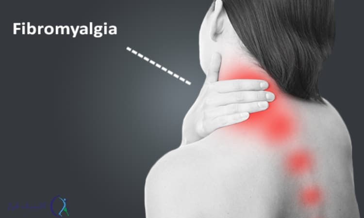 فیبرومیالژیا