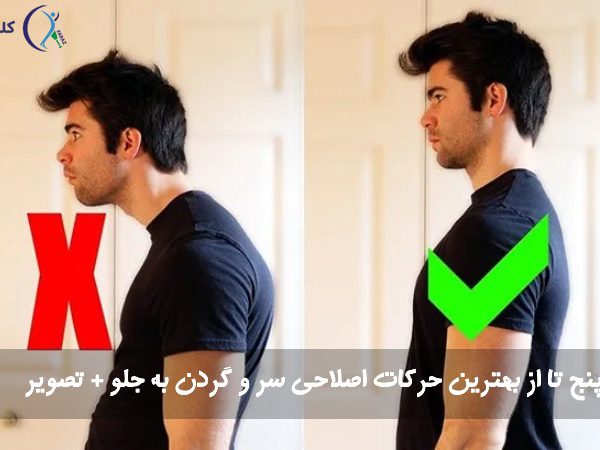 حرکات اصلاحی سر و گردن به جلو