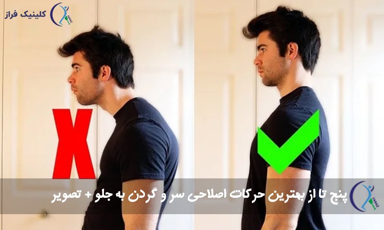 حرکات اصلاحی سر و گردن به جلو