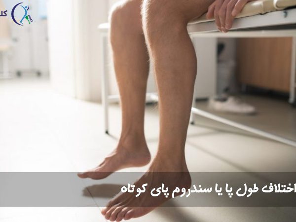 اختلاف طول پا