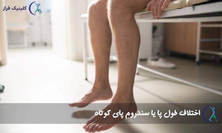 اختلاف طول پا