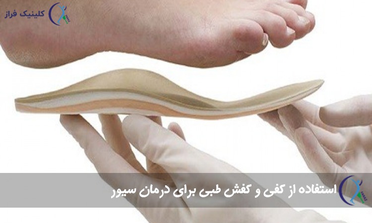 کفی و کفش طبی برای درمان سیور