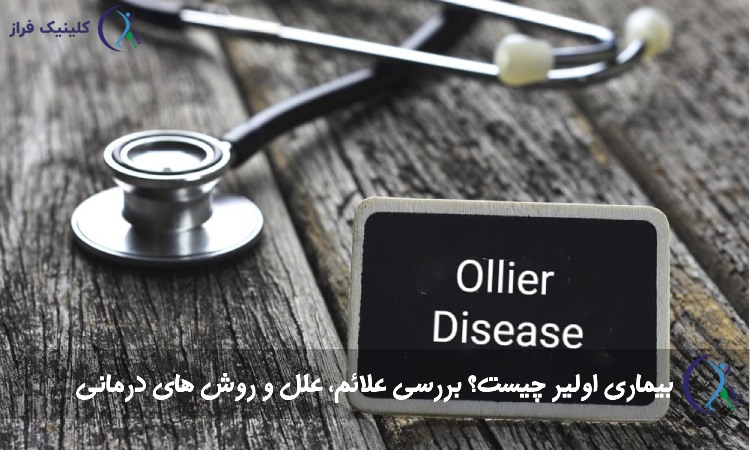 بیماری اولیر