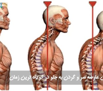 گردن به جلو