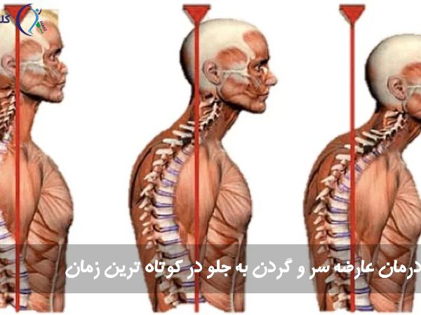 گردن به جلو