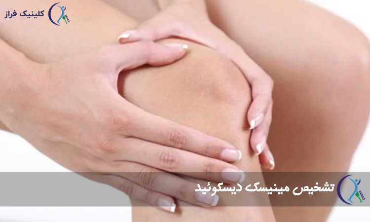 تشخیص مینیسک دیسکوئید