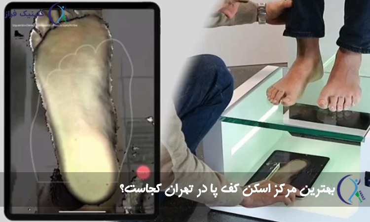 بهترین مرکز اسکن کف پا در تهران
