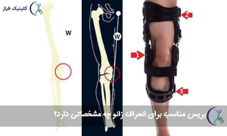 بریس مناسب برای انحراف زانو