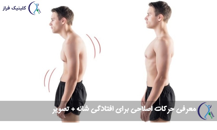 حرکات اصلاحی برای افتادگی شانه