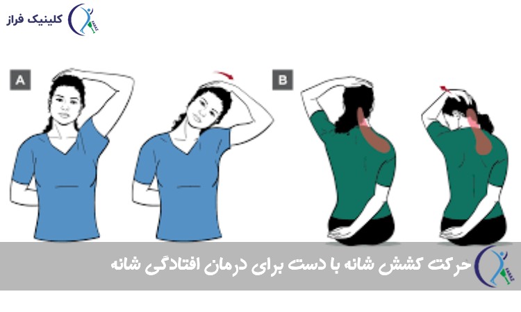 کشش ذوزنقه ای بخش فوقانی بدن جهت بهبود افتادگی شانه