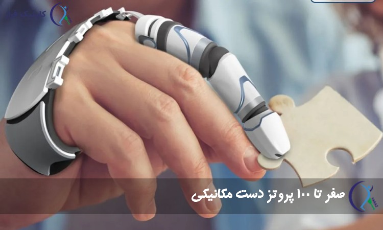 پروتز دست مکانیکی