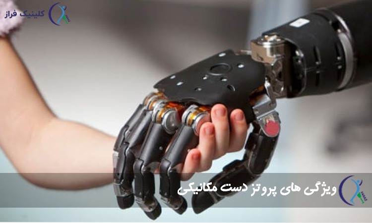 مزایای پروتز دست مکانیکی