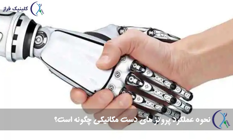 عملکرد پروتز های دست مکانیکی