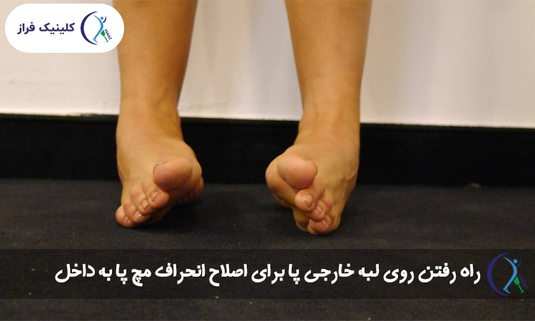 راه رفتن روی لبه خارجی پا