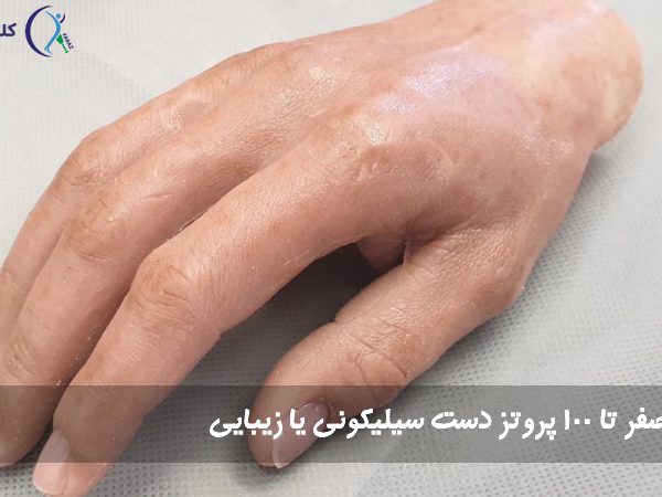 پروتز دست سیلیکونی