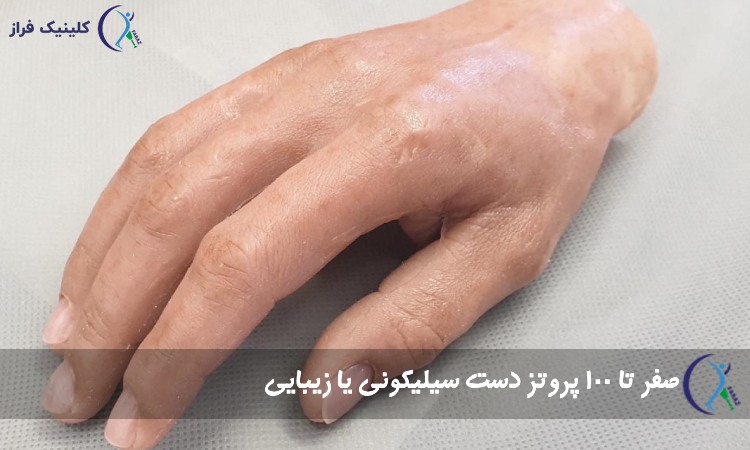 پروتز دست سیلیکونی
