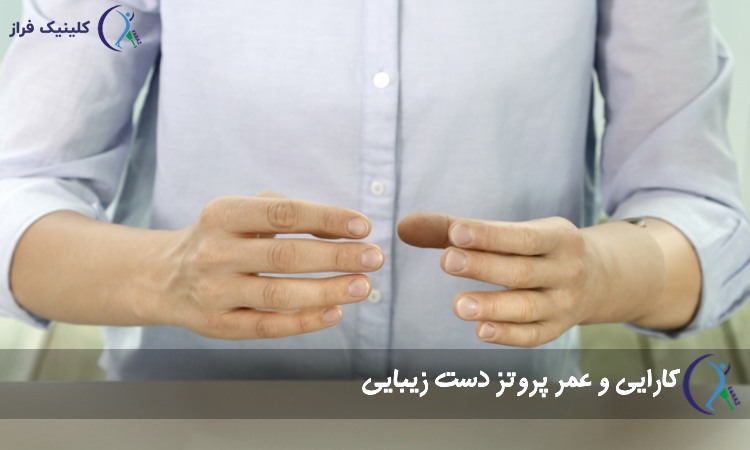 کارایی و عمر پروتز دست زیبایی