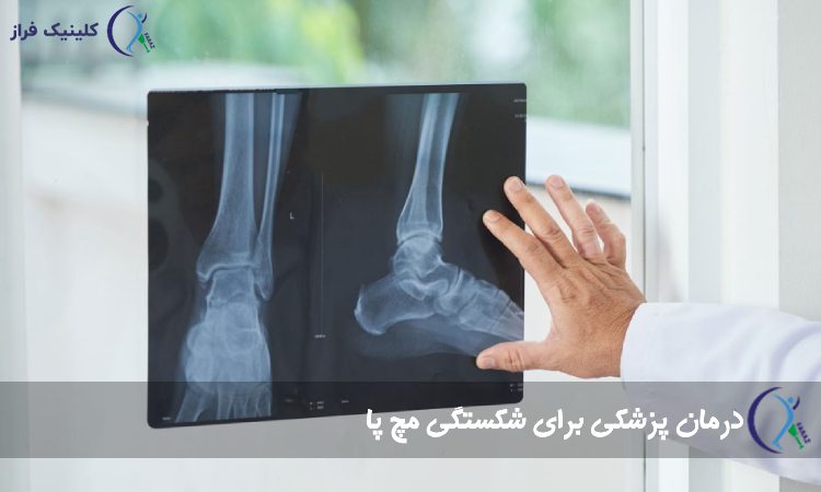 جراحی شکستگی استخوان