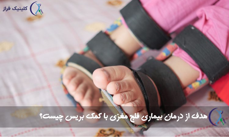 درمان بیماری فلج مغزی