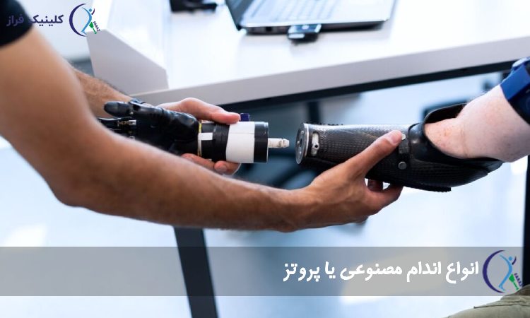 انواع اندام مصنوعی یا پروتز