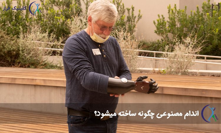 ساخت پروتز های مصنوعی