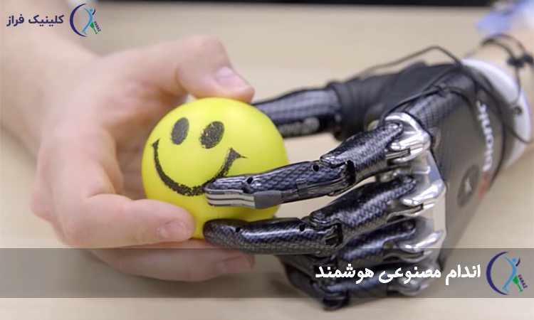پروتز هوشمند