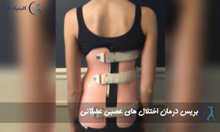 بریس اسکولیوز عصبی عضلانی