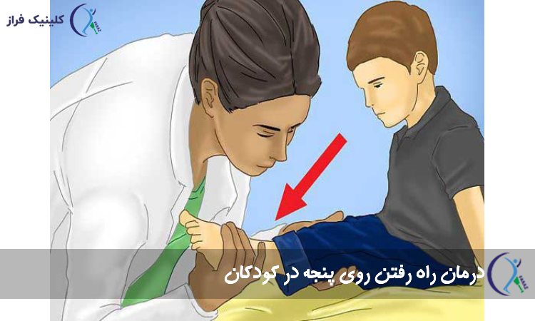 درمان راه رفتن روی پنجه در کودکان