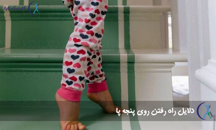 دلایل راه رفتن روی پنجه پا