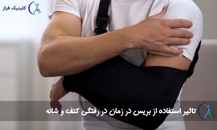 تاثیر استفاده از بریس