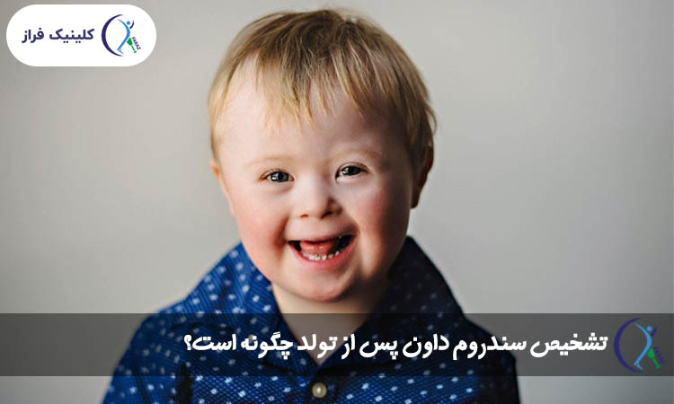 تشخیص سندروم داون پس از تولد چگونه است؟