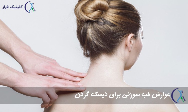 عوارض طب سوزنی برای دیسک گردن