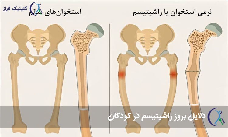 راشتیسم 