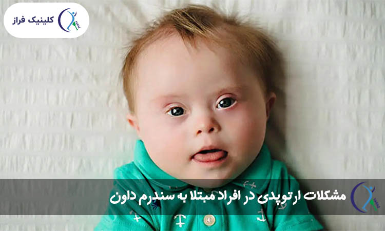 مشکلات ارتوپدی در افراد مبتلا به سندروم داون