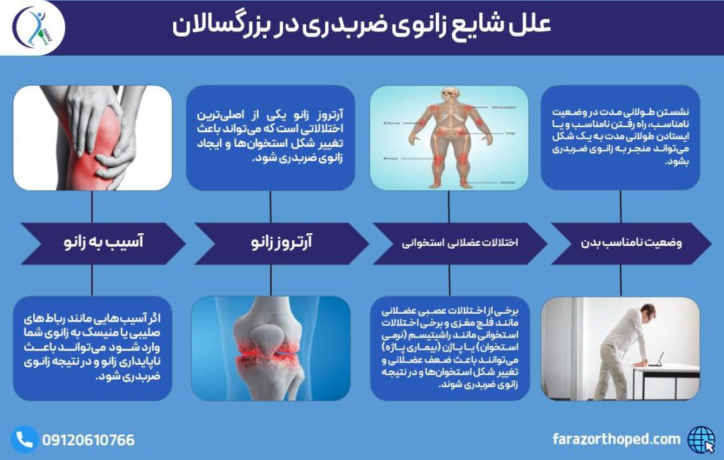 علت زانوی ضربدری