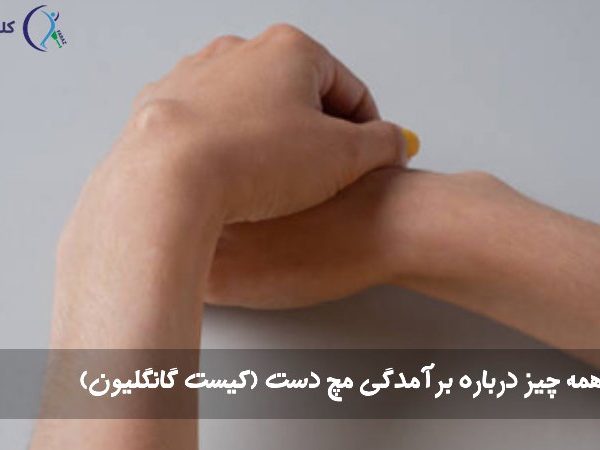کیست مچ دست