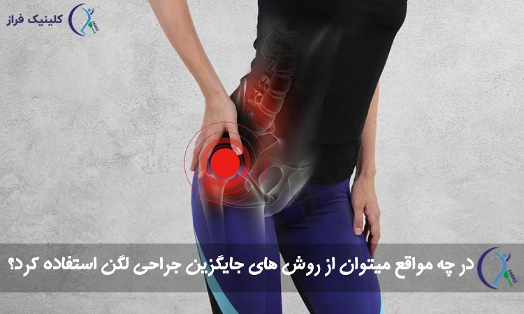 روش های جایگزین تعویض مفصل لگن