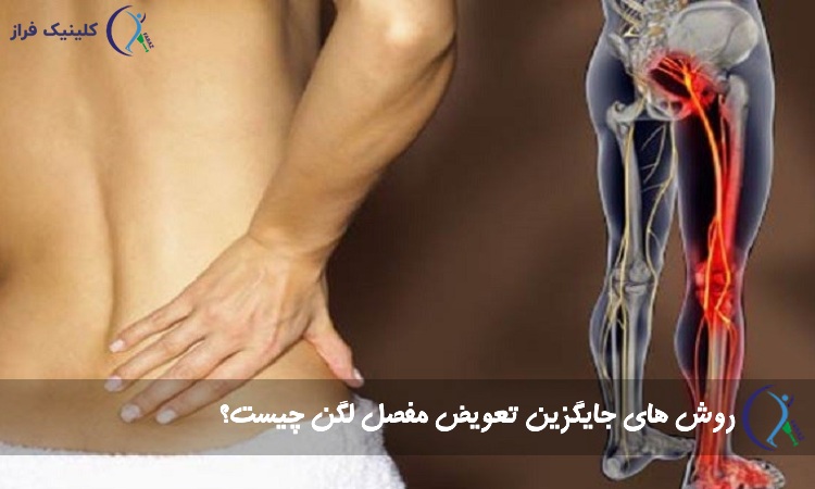 راه جایگزین تعویض لگن